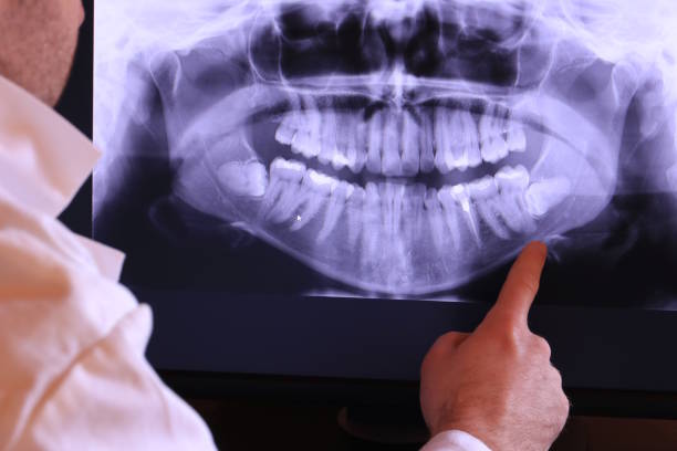 Best Emergency Dental Extractions in Groveton, VA