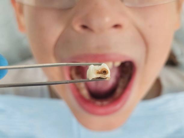 Best Mobile Emergency Dentist in Groveton, VA