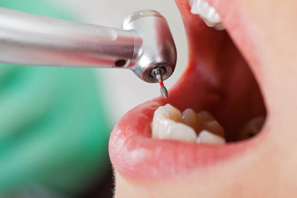 Best Emergency Dentist for Knocked-Out Tooth in Groveton, VA